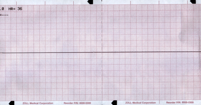 M3 Fig 6 Cardiac Arrest Asystole