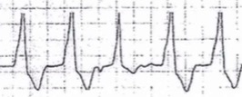 M3 Fig 7b Circulation-capture-beat