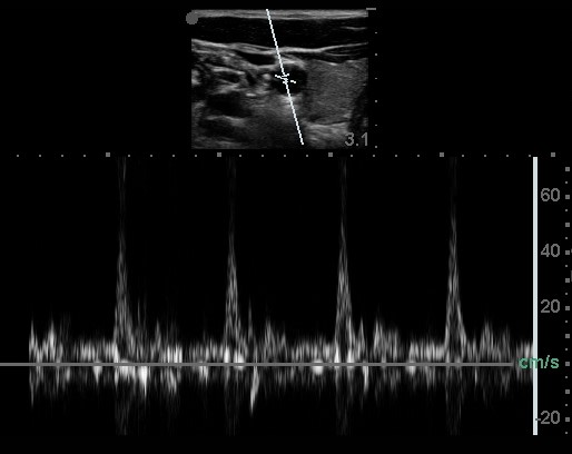 M3 Fig 8 Bedside Ultrasound -doppler