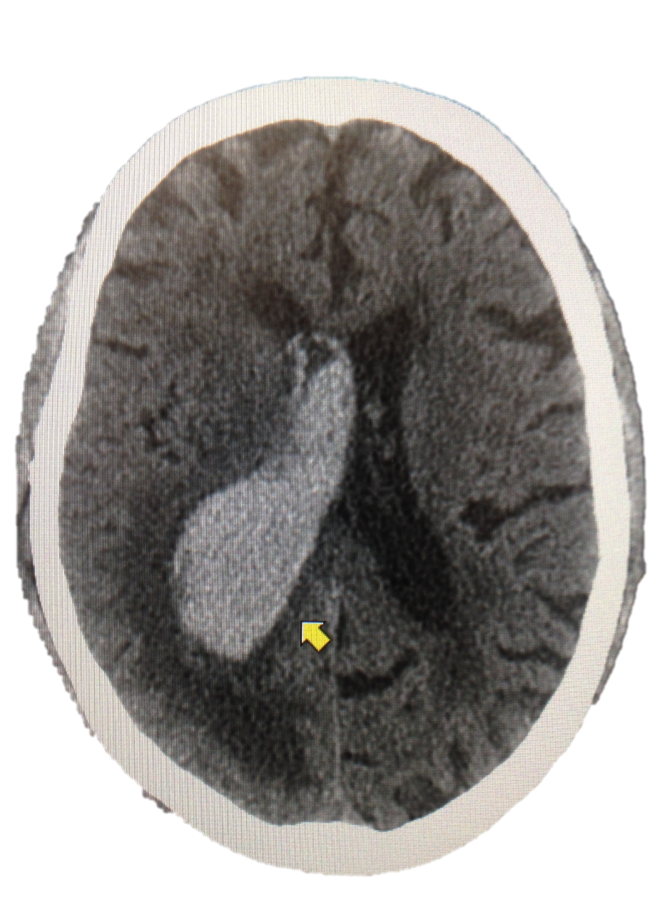 M4 Fig 6 Closed Head Injury